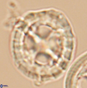 Prediscosphaera grandis 11935