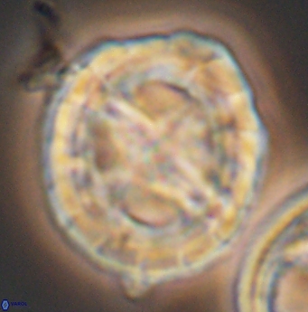 Prediscosphaera grandis 11936