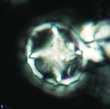 Prediscosphaera grandis 3166