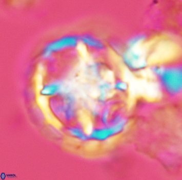 Prediscosphaera grandis 3167