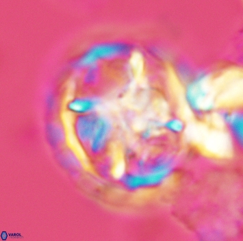 Prediscosphaera grandis 3168