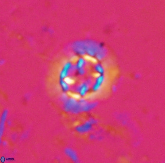 Prediscosphaera decorata 34685
