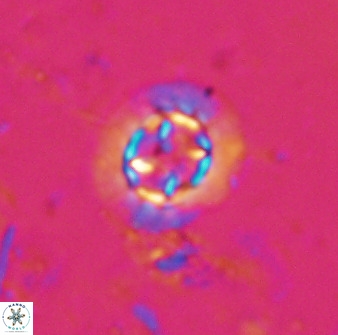 Prediscosphaera decorata 34685
