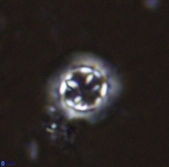 Prediscosphaera decorata 34686