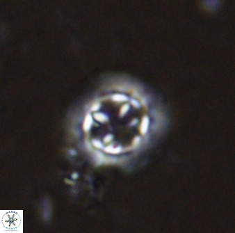 Prediscosphaera decorata 34686