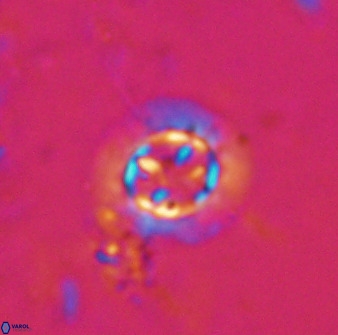 Prediscosphaera decorata 34687