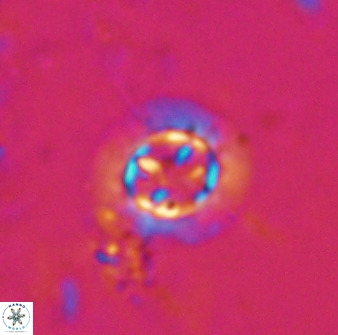 Prediscosphaera decorata 34687