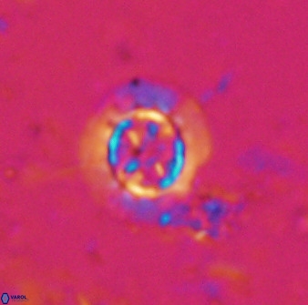 Prediscosphaera decorata 34688