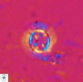 Prediscosphaera decorata 34688