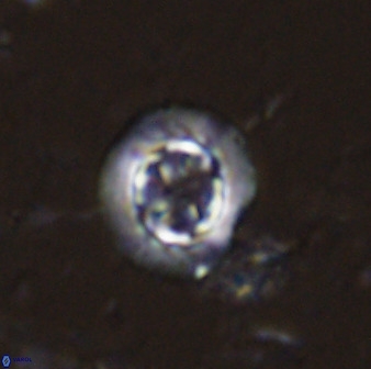 Prediscosphaera decorata 34689