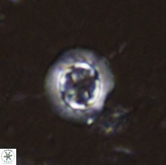 Prediscosphaera decorata 34689