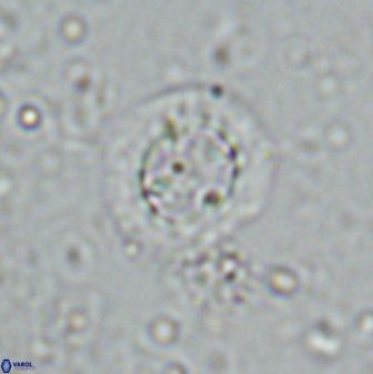 Prediscosphaera decorata 34690