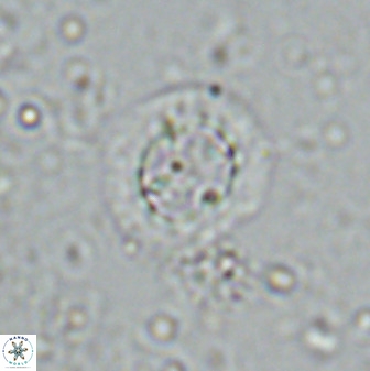 Prediscosphaera decorata 34690