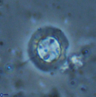 Prediscosphaera decorata 34691