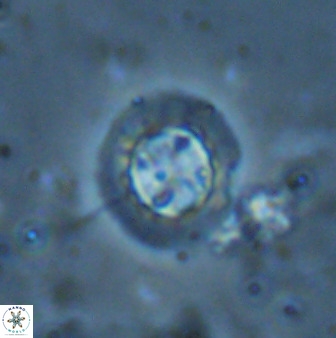 Prediscosphaera decorata 34691
