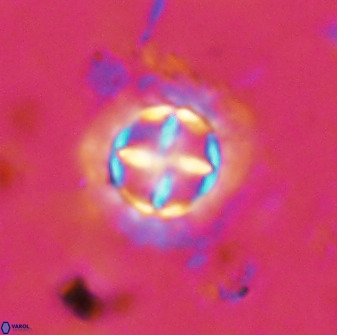 Prediscosphaera decorata 38328
