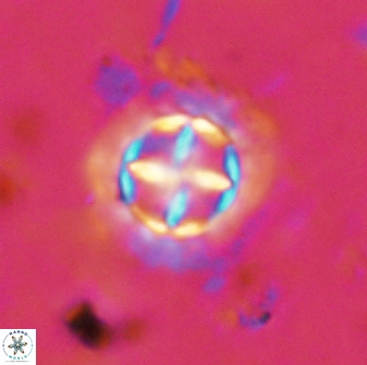 Prediscosphaera decorata 38328