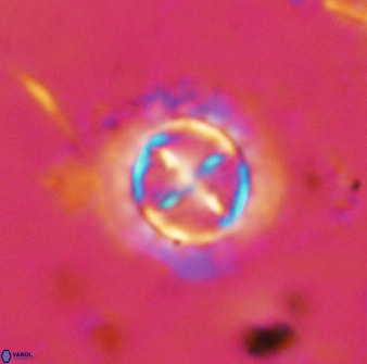 Prediscosphaera decorata 38330