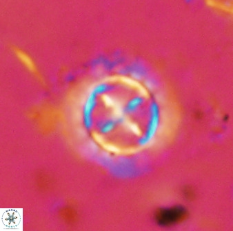Prediscosphaera decorata 38330