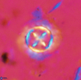 Prediscosphaera decorata 38332