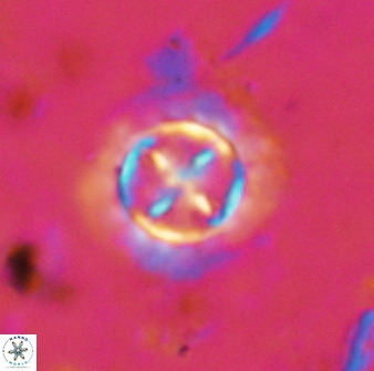 Prediscosphaera decorata 38332