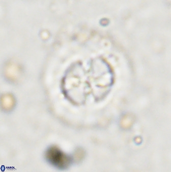 Prediscosphaera decorata 38333