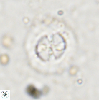 Prediscosphaera decorata 38333