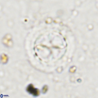 Prediscosphaera decorata 38334