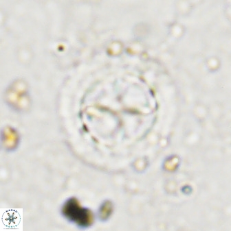 Prediscosphaera decorata 38334