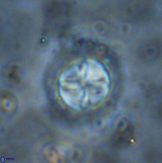 Prediscosphaera decorata 38335
