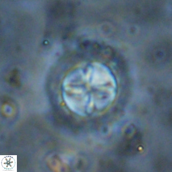 Prediscosphaera decorata 38335