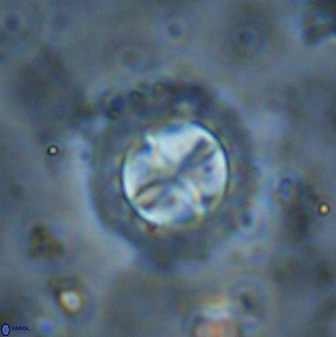Prediscosphaera decorata 38336