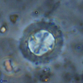 Prediscosphaera decorata 38337