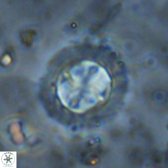 Prediscosphaera decorata 38337