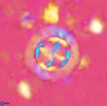 Prediscosphaera decorata 4763