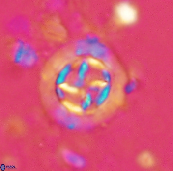 Prediscosphaera decorata 4764