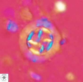 Prediscosphaera decorata 4764