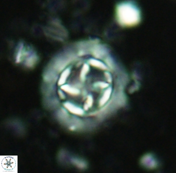Prediscosphaera decorata 4765