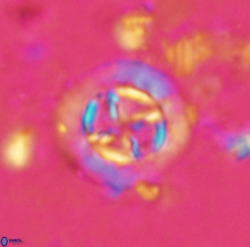 Prediscosphaera decorata 4769