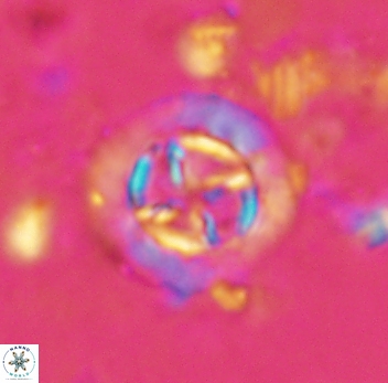 Prediscosphaera decorata 4769