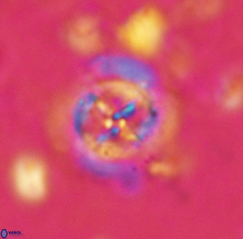 Prediscosphaera decorata 4771