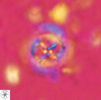 Prediscosphaera decorata 4771