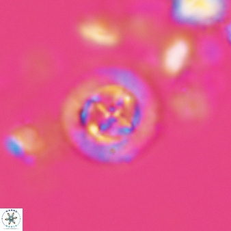 Prediscosphaera decorata 802