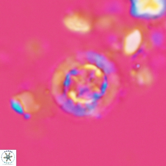 Prediscosphaera decorata 803