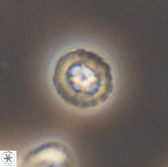 Prediscosphaera decorata 8841