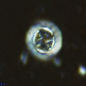Prediscosphaera decorata VR 11855