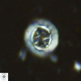 Prediscosphaera decorata VR 11855