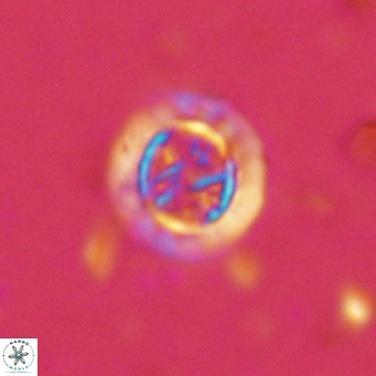 Prediscosphaera decorata VR 11856