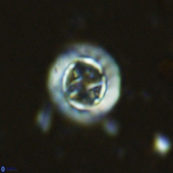 Prediscosphaera decorata VR 11857