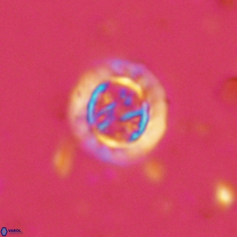 Prediscosphaera decorata VR 11858